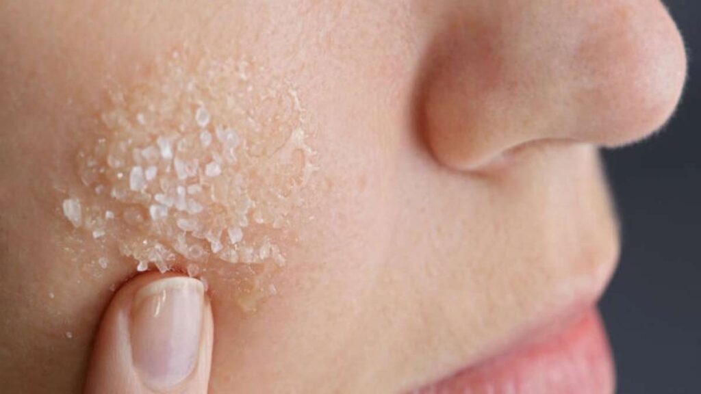 8 tips para prevenir la piel seca