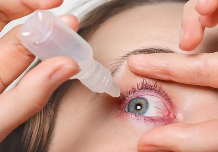 Glaucoma: La importancia de detectarlo a tiempo